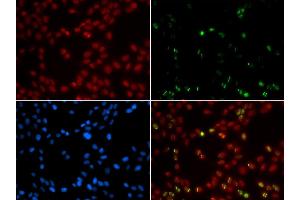 Image no. 3 for anti-Small Ubiquitin Related Modifier Protein 1 (SUMO1) antibody (ABIN3022994)