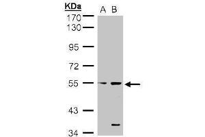 Image no. 2 for anti-serine/threonine/tyrosine Kinase 1 (STYK1) (Center) antibody (ABIN2856191)