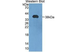 Image no. 1 for anti-Heat Shock Transcription Factor 4 (HSF4) (AA 91-407) antibody (ABIN5013675)