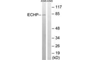 Image no. 1 for anti-Enoyl-CoA, Hydratase/3-Hydroxyacyl CoA Dehydrogenase (EHHADH) (AA 476-525) antibody (ABIN1535147)