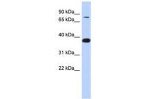 Image no. 1 for anti-Zinc Finger Protein 526 (ZNF526) (AA 179-228) antibody (ABIN6740285)