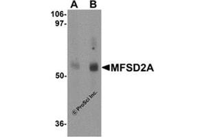 MFSD2A 抗体  (C-Term)
