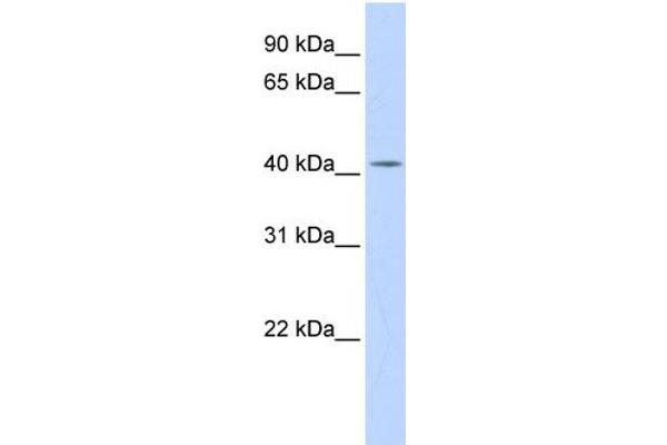 anti-Dehydrodolichyl Diphosphate Synthase (DHDDS) (N-Term) antibody