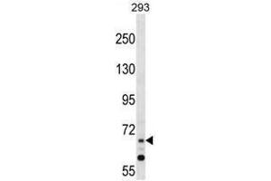 Image no. 1 for anti-Zinc Finger Protein 214 (ZNF214) (AA 30-59), (N-Term) antibody (ABIN955689)