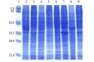 SDS-PAGE (SDS) image for Human Cell Line II Blot (ABIN2455958)