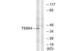 Image no. 1 for anti-Testis Specific Serine Kinase 4 (TSSK4) (AA 211-260) antibody (ABIN1535408)