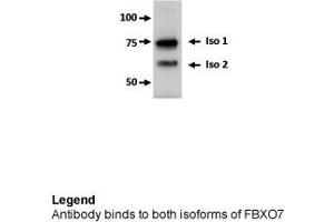 Image no. 4 for anti-F-Box Protein 7 (FBXO7) (Middle Region) antibody (ABIN2774701)