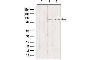 Image no. 2 for anti-Zinc Finger Protein 148 (ZNF148) (N-Term) antibody (ABIN6266110)