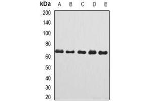 Image no. 1 for anti-Complement Component 8, beta Polypeptide (C8B) (full length) antibody (ABIN6043246)