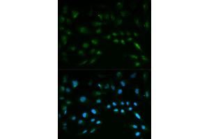 Image no. 1 for anti-Nuclear Factor (erythroid-Derived 2)-Like 2 (NFE2L2) antibody (ABIN3021832)