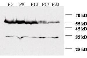 Image no. 1 for anti-Zinc Finger Protein ZIC 1 (ZIC1) (N-Term) antibody (ABIN6657599)