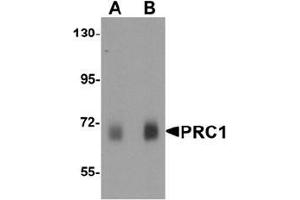 Image no. 2 for anti-Protein Regulator of Cytokinesis 1 (PRC1) (Middle Region) antibody (ABIN1449936)