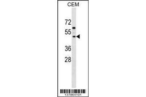 Image no. 1 for anti-F-Box and Leucine-Rich Repeat Protein 8 (FBXL8) (AA 57-83), (N-Term) antibody (ABIN1539473)