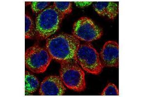 Image no. 2 for anti-phosphodiesterase 4D, cAMP-Specific (PDE4D) (C-Term) antibody (ABIN2855885)