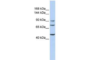 Image no. 1 for anti-UDP-N-Acetyl-alpha-D-Galactosamine:polypeptide N-Acetylgalactosaminyltransferase 5 (GalNAc-T5) (GALNT5) (Middle Region) antibody (ABIN2782819)