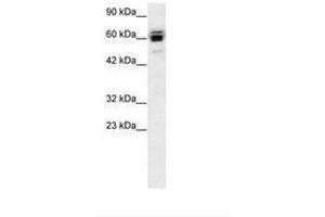 Image no. 2 for anti-Ring Finger Protein, LIM Domain Interacting (RLIM) (AA 532-581) antibody (ABIN6735780)