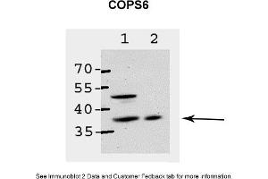Image no. 1 for anti-COP9 Signalosome Complex Subunit 6 (COPS6) (Middle Region) antibody (ABIN2788037)