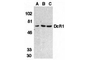 Western Blotting (WB) image for anti-Tumor Necrosis Factor Receptor Superfamily, Member 10c (TNFRSF10C) (2nd Extracellular Domain) antibody (ABIN1030838)