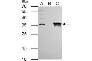 Image no. 2 for anti-General Transcription Factor IIE, Polypeptide 2 (GTF2E2) (Center) antibody (ABIN2856018)
