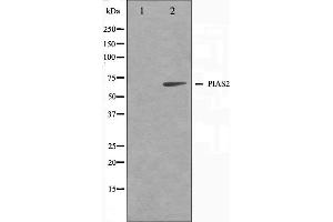 Image no. 1 for anti-Protein Inhibitor of Activated STAT, 2 (PIAS2) antibody (ABIN6264196)