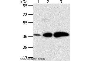 Image no. 3 for anti-Dihydrodiol Dehydrogenase (DDH) antibody (ABIN2426547)