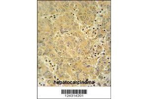 Image no. 2 for anti-Cytochrome P450, Family 2, Subfamily A, Polypeptide 7 (CYP2A7) (AA 121-148) antibody (ABIN654434)