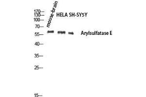 Image no. 1 for anti-Arylsulfatase E (ARSE) (Internal Region) antibody (ABIN3183387)
