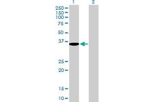 Image no. 1 for anti-serine Dehydratase (SDS) (AA 1-328) antibody (ABIN524389)