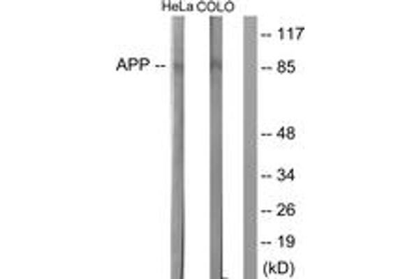 beta Amyloid anticorps  (AA 711-760)
