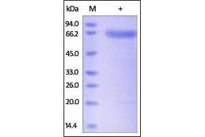 Human PH20, His Tag on SDS-PAGE under reducing (R) condition.
