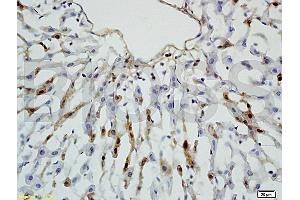 Formalin-fixed and paraffin embedded rat colon tissue labeled with Rabbit Anti-Leptin receptor(long) Polyclonal Antibody (ABIN725060) at 1:200 followed by conjugation to the secondary antibody and DAB staining