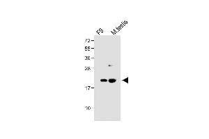 VHL anticorps  (N-Term)