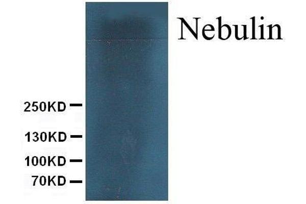 anti-Nebulin (NEB) antibody