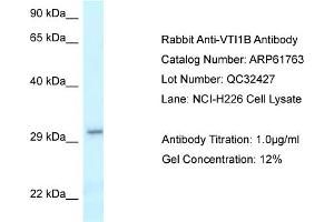 Image no. 1 for anti-Vesicle Transport through Interaction with T-SNAREs Homolog 1B (VTI1B) (C-Term) antibody (ABIN2788893)