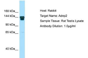 Image no. 1 for anti-ADNP Homeobox 2 (ADNP2) (N-Term) antibody (ABIN2780954)