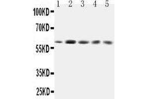Image no. 1 for anti-Growth Factor Receptor-Bound Protein 7 (GRB7) (AA 124-141), (Middle Region) antibody (ABIN5518677)