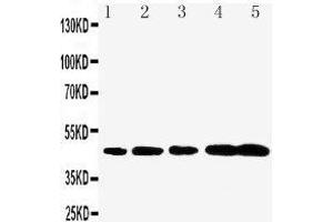 anti-Caspase 1 (CASP1) (AA 135-152), (N-Term) antibody