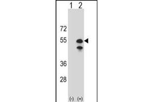 CPN1 Antikörper  (N-Term)