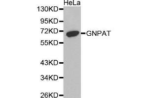 Image no. 1 for anti-Glyceronephosphate O-Acyltransferase (GNPAT) antibody (ABIN1680058)