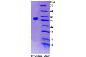 Image no. 1 for Dyskeratosis Congenita 1, Dyskerin (DKC1) (AA 298-509) protein (T7 tag,His tag) (ABIN6239094)