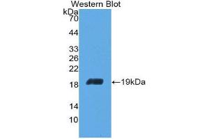Image no. 1 for anti-Aconitase 1 (ACO1) (AA 669-834) antibody (ABIN1857865)