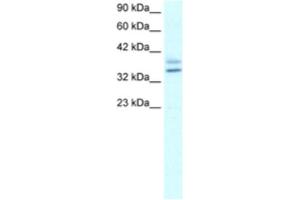 Image no. 1 for anti-Ets Homologous Factor (EHF) antibody (ABIN2460300)