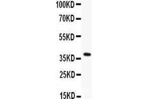 Image no. 1 for anti-Methyl-CpG Binding Domain Protein 2 (MBD2) (AA 159-411) antibody (ABIN3043613)