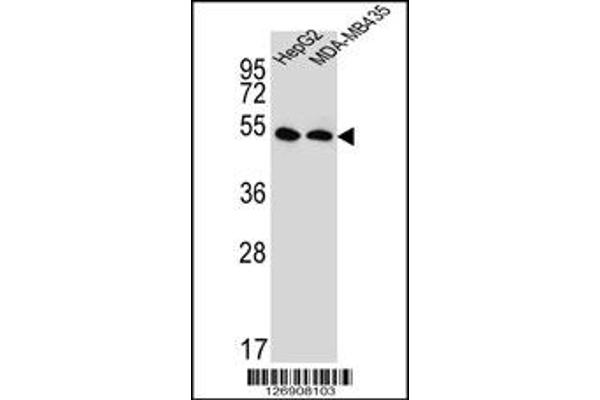 anti-Solute Carrier Family 47, Member 1 (SLC47A1) (C-Term) antibody