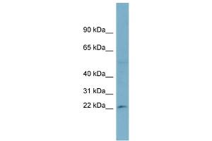 Image no. 1 for anti-Ribosomal Protein L13a (RPL13A) (Middle Region) antibody (ABIN2787723)