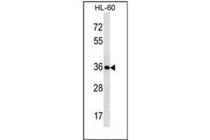 Image no. 2 for anti-Kallikrein 9 (KLK9) (AA 81-111), (Middle Region) antibody (ABIN953103)