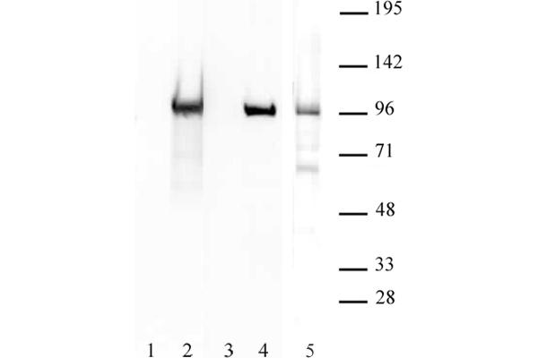 anti-CCCTC-Binding Factor (Zinc Finger Protein)-Like (CTCFL) (N-Term) antibody