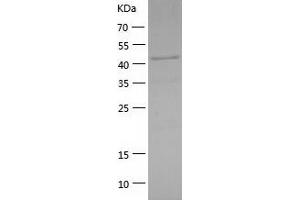 IKBKG Protein (AA 1-419) (His tag)