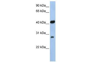 Image no. 1 for anti-Zinc Finger, AN1-Type Domain 3 (ZFAND3) (N-Term) antibody (ABIN2775814)