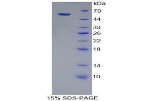 Image no. 1 for Cathepsin A (CTSA) (AA 151-394) protein (His tag,GST tag) (ABIN1878931)
